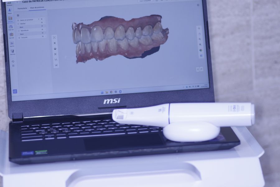 Escáner intraoral 3D conectado a un ordenador portátil en la clínica