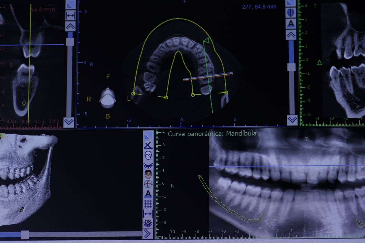 TAC dental para diagnóstico odontológico avanzado en Clínica Javier Corzo, Granada